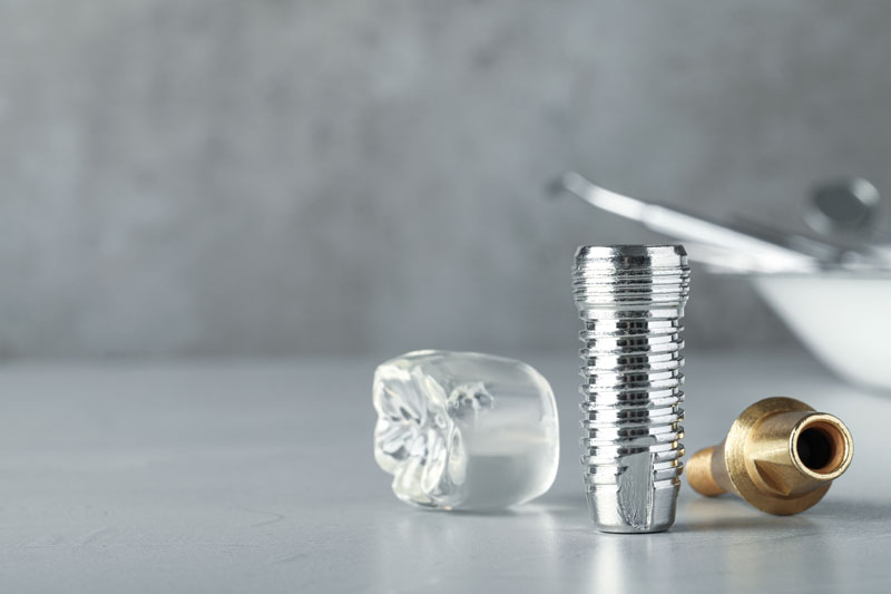 Exploring the World of Bottom Teeth Implants: What’s, Whys, and How’s